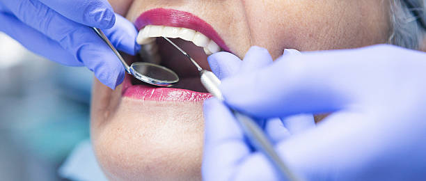 Best Knocked-Out Tooth (Avulsed Tooth) Treatment in Oreland, PA
